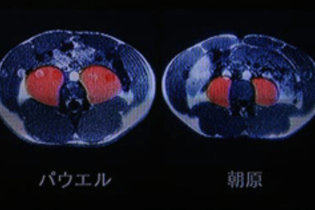 スプリンターの腸腰筋